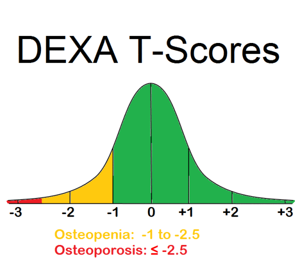 high t score meaning statistics